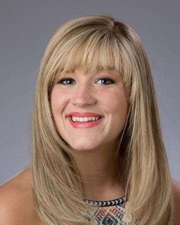 Women’s hair restoration in Slidell and New Orleans, gallery image 2 Women’s hair restoration in Slidell and New Orleans, gallery image 2