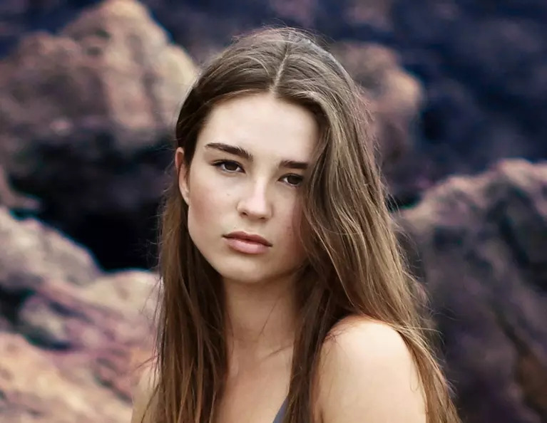 Women’s surgical hair loss treatment in Slidell and New Orleans Women’s surgical hair loss treatment in Slidell and New Orleans